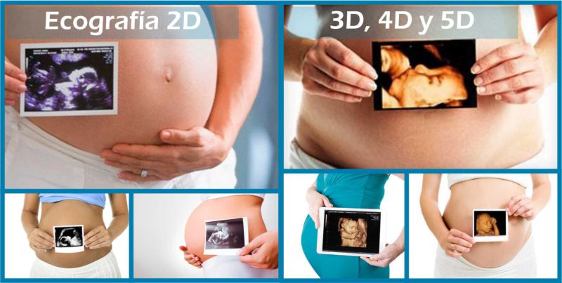 diferencia de ecografias 2d 3d 4d y 5d